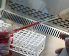 Türk biliminsanları yapay kan üretmeyi başardı